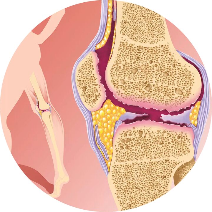 Hondrotène – Soutient la mobilité articulaire